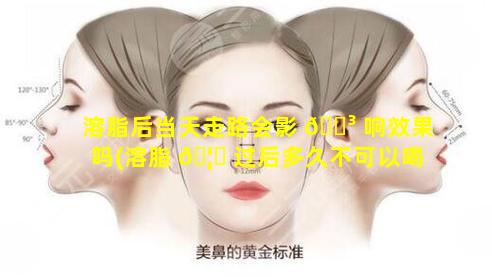 溶脂后当天走路会影 🐳 响效果吗(溶脂 🦆 过后多久不可以喝酒)